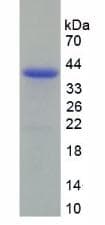 Human DCN / Decorin Protein (Recombinant His)