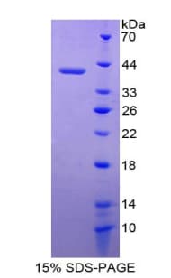 Human LEFTYB / LEFTY1 Protein (Recombinant His-T7)