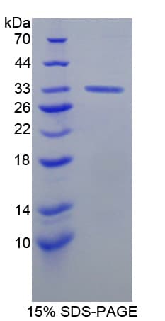 Mouse ERBB3 / HER3 Protein (Recombinant His-T7)