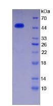 Human Antithrombin Protein (Recombinant His)