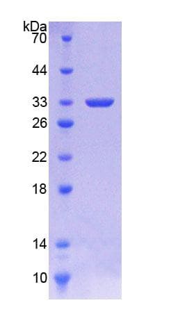 Human Antithrombin Protein (Recombinant His-T7)