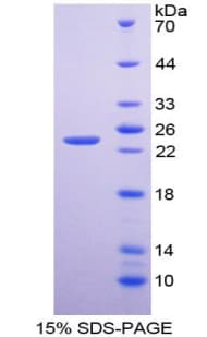 Human BMF Protein (Recombinant His, N-Terminal)