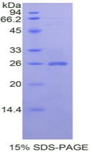 Mouse CLCF1 Protein (Recombinant His, N-Terminal)