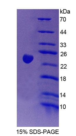 Human GAMT Protein (Recombinant His-T7)