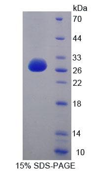 Human LYPLA1 Protein (Recombinant His-T7)