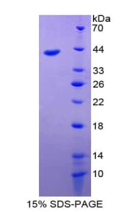 Human VIL1 / Villin Protein (Recombinant His-T7)