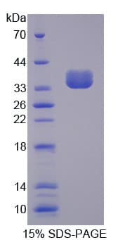 Human VCP Protein (Recombinant His)