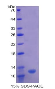 Human OAS1 Protein (Recombinant His)