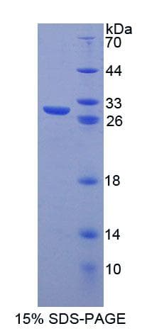 Human Securin / PTTG1 Protein (Recombinant His-T7)