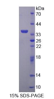 Human TP / Thymidine Phosphorylase Protein (Recombinant His-T7)