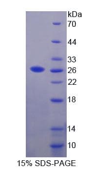Human SRPRB Protein (Recombinant His-T7)