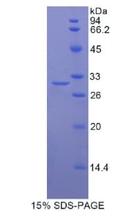 Human LRPAP1 Protein (Recombinant His)