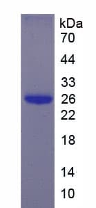 Human EBI3 / IL-27B Protein (Recombinant His)