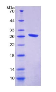 Rat Complement C1QA Protein (Recombinant His-T7)