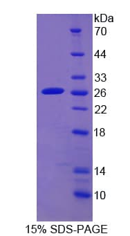 Human CYP2D6 Protein (Recombinant His)
