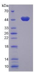 Human SERPINB5 / Maspin Protein (Recombinant His)