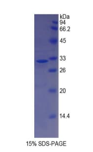 Human MYH14 Protein (Recombinant His)