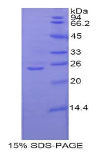 Rat GCLC Protein (Recombinant His)