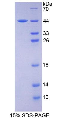 Mouse ASNS Protein (Recombinant His-S)