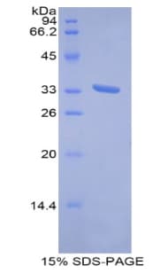 Human MT1E Protein (Recombinant His-GST)