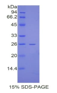 Mouse CREBBP / CREB Binding Protein (Recombinant His)