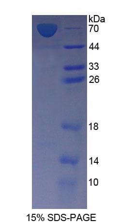 Rat FDPS Protein (Recombinant His-GST)