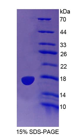 Mouse IDO2 / INDOL1 Protein (Recombinant His)