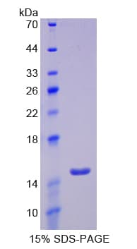 Human SLC2A14 Protein (Recombinant His-T7)