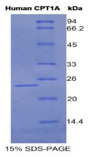Human CPT1A Protein (Recombinant His)