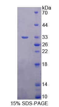 Rat DOK3 Protein (Recombinant His-T7)