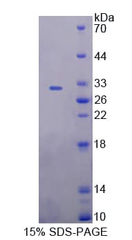 Rat DOK7 Protein (Recombinant His-T7)