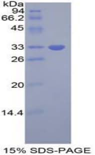 Human GRB7 Protein (Recombinant His-T7)