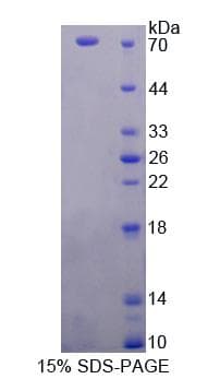 Human PPOX Protein (Recombinant His-GST)
