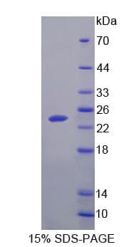 Human SAT1 / SAT Protein (Recombinant His-S)