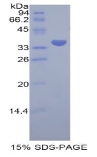Human PRAME Protein (Recombinant His-GST)