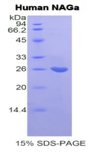 Human NAGA Protein (Recombinant His)
