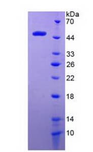 Mouse HTT / Huntingtin Protein (Recombinant His-GST)