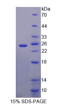 Mouse CITED1 Protein (Recombinant His-T7)
