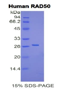 Human RAD50 Protein (Recombinant His)