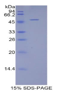 Human BCL2L2 / Bcl-w Protein (Recombinant His)