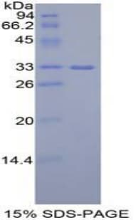 Mouse IGF2BP2 Protein (Recombinant His-T7)