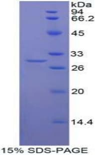 Human MIB2 Protein (Recombinant His-T7)