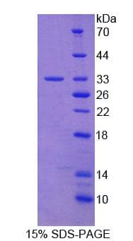 Human FLG2 Protein (Recombinant His)