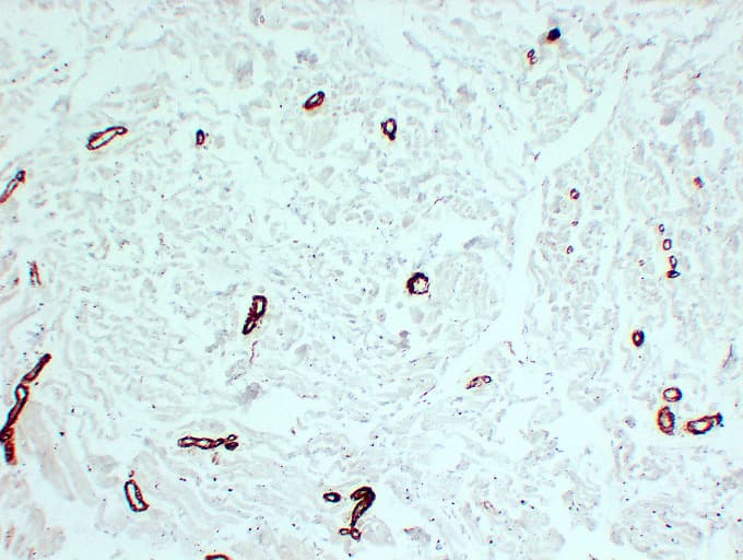 Smooth Muscle Actin Antibody (clone ABT-SMA)