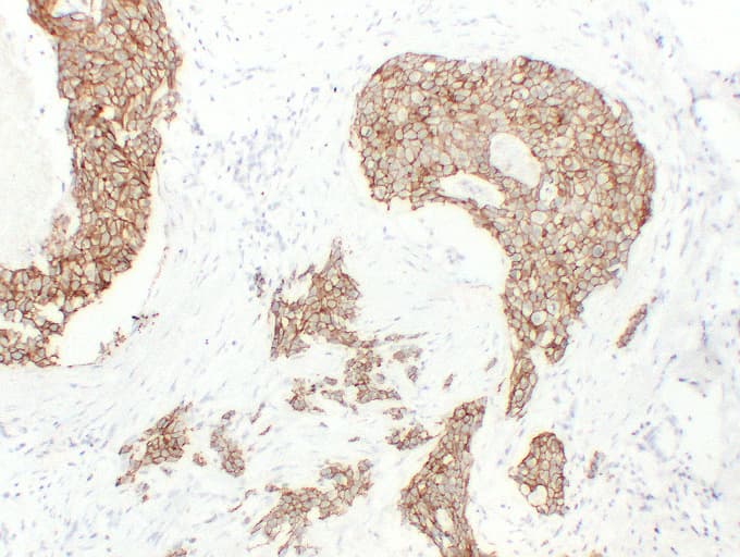 Cadherin Antibody (clone ABT-MCDH)