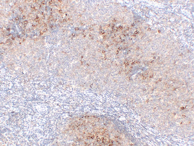Monoclonal Mouse anti-Human FCER2 / CD23 Antibody (clone ABT-CD23, IHC)