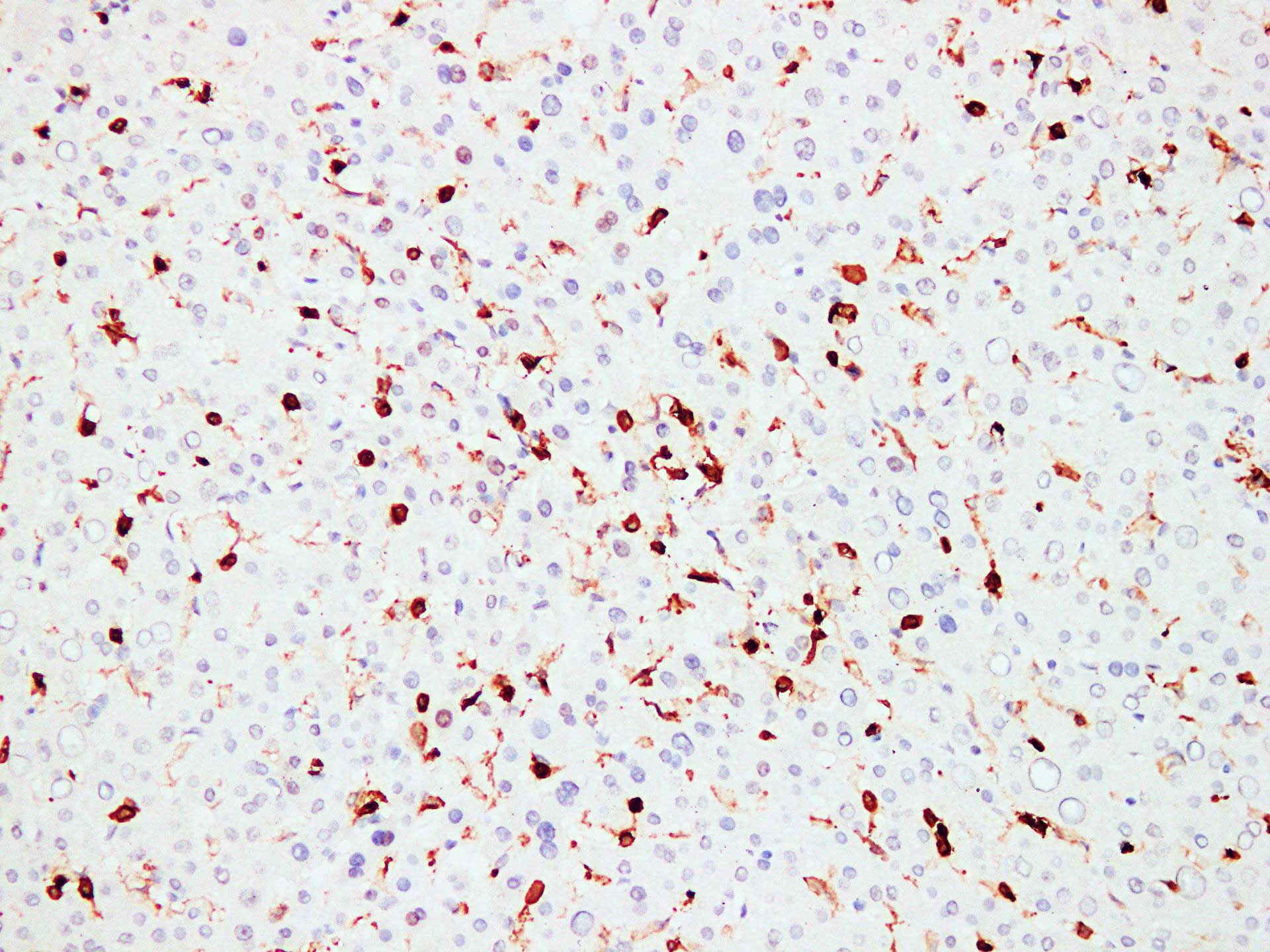 Monoclonal Mouse anti-Human CD45 / LCA Antibody (clone ABT-CD45, IHC)