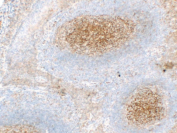 ICAM-1 / CD54 Antibody (clone ABT-CD54)