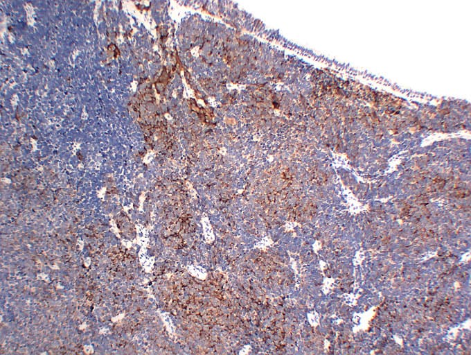 CHGA / Chromogranin A Antibody (clone ABT-CGA)