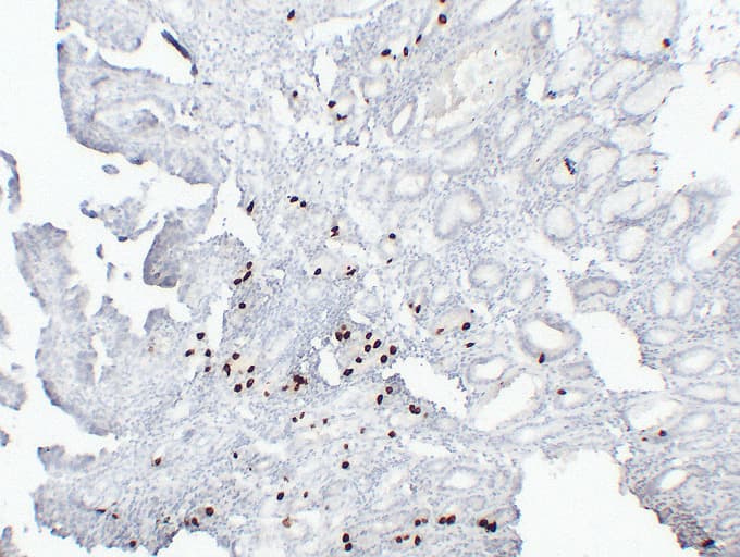 Gastrin Antibody (clone ABT-GAST)